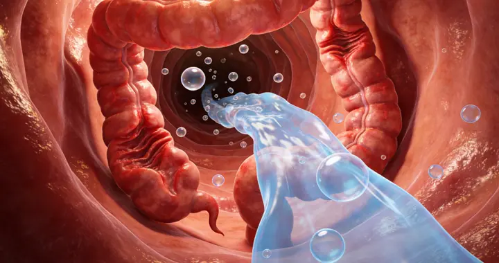 经常腹痛腹泻跑厕所？记住这个中成药，帮你温肾健脾远离肠易激