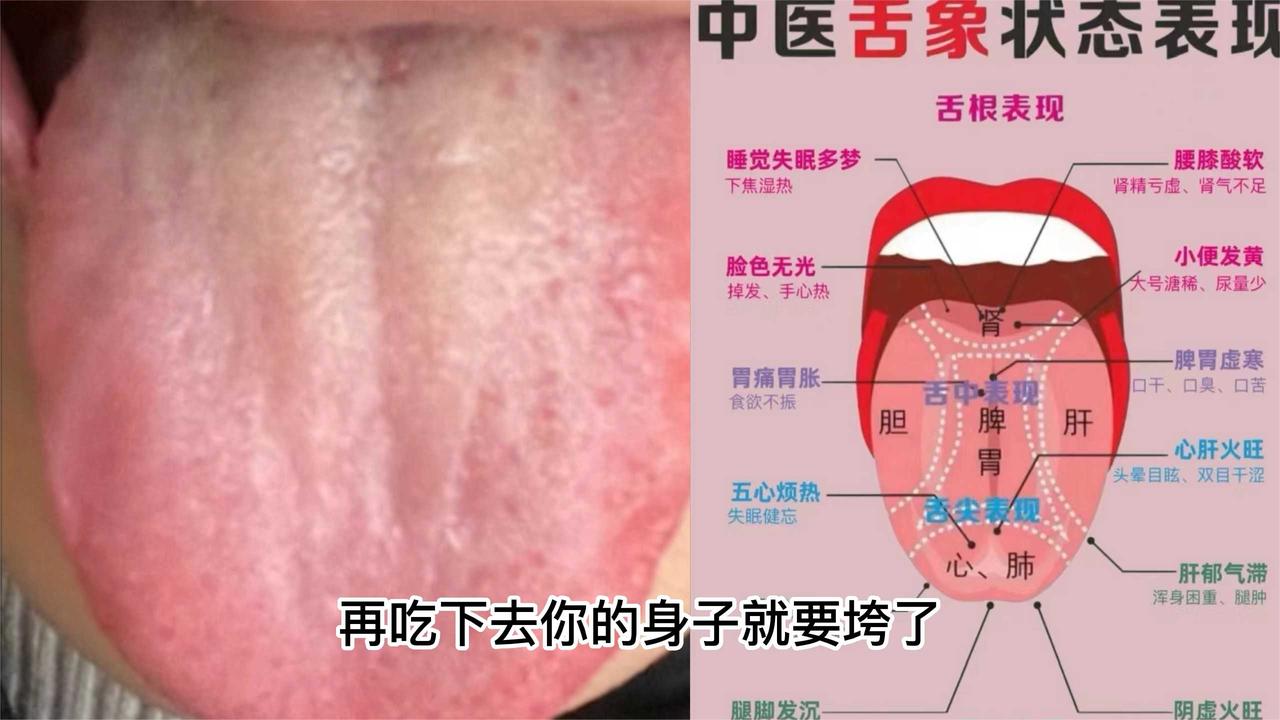 今日舌象分析——手脚冰凉、多梦、容易醒，尿频——肝郁脾虚