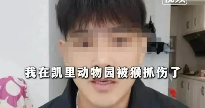 凯里动物园被猴子抓伤赔偿1000元后续，完整版视频曝光，早有预谋