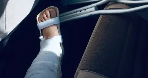 骨折后必吃的5类食物你知道有哪些吗？