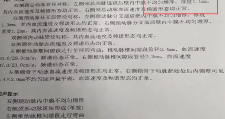 医生：颈动脉斑块没超过这个“厚度”，大多不用吃他汀，别吓自己