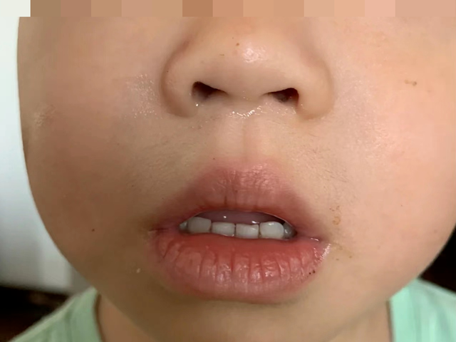 立秋后，用它给孩子泡脚，补阳气！阳气足了湿气散了，鼻炎也没了