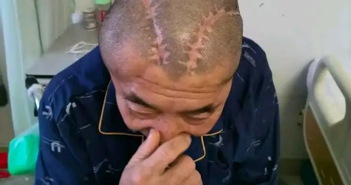 右脑出血竟被开左颅？包头市中心医院三年医疗纠纷调查