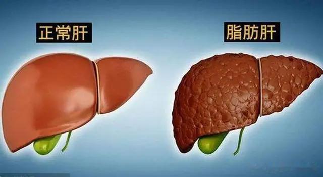 中西不同视角下的养肝方式