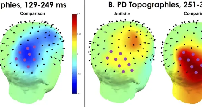 为啥自闭症孩子要么死机，要么上头停不下来，科学家找到了答案