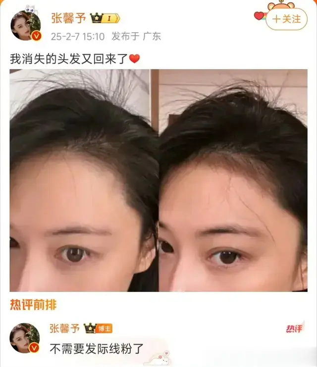 张馨予秀浓密黑发，直言消失的头发回来了，姐姐求教程