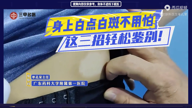 身上白点白斑是不是白癜风？如何正确辨别早期白癜风？