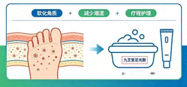 脚气反反复复?原来一直做错了这件事!