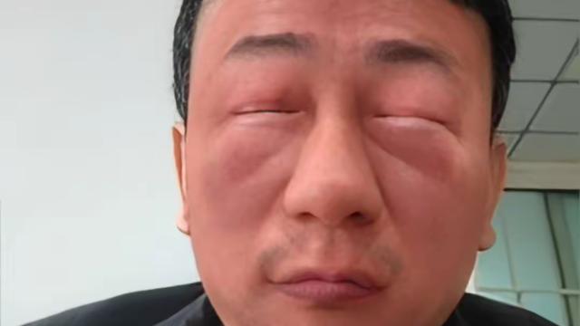 用中华利剑：张三买香春芽回家炒鹅蛋 不料