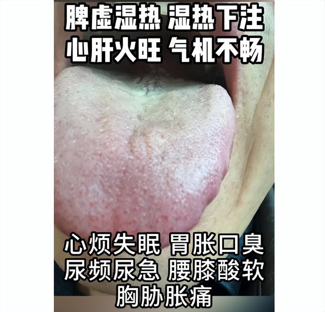 门诊3大典型男科案例——阳虚，湿热下注，中途疲软，时间短