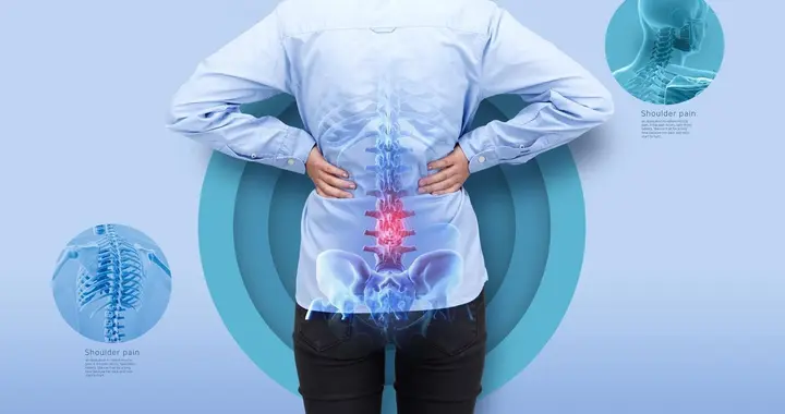 调理腰椎间盘突出症常见类型及方剂