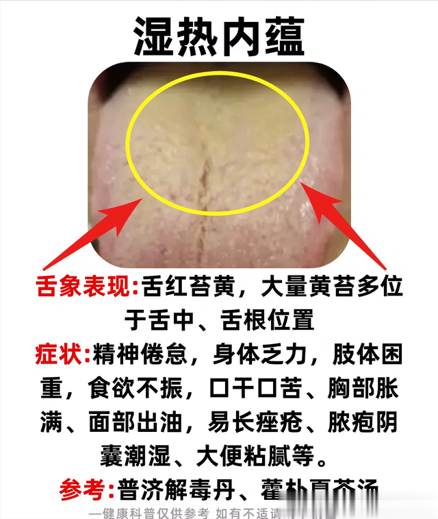 张医生舌诊：都是舌苔黄腻，但是原因各不相同，中医带你一一辩证