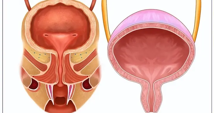 医生研究：天天坚持提肛的前列腺患者，不出半年，身体迎来5变化