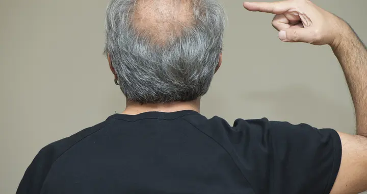 医生发现，凡是白发少的老人，大多都有这2个共性，注意观察