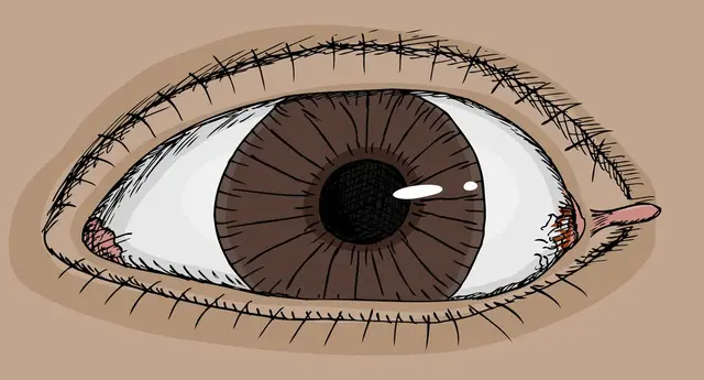 有癌入体，眼睛先知！眼睛出现3种变化，多半是癌上身
