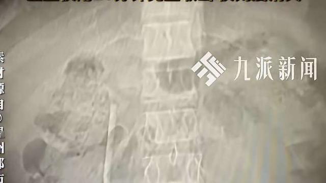 英子健康科普：32岁的王先生最近肚子总不