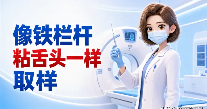 肺癌活检有了新办法: 像“铁栏杆粘舌头”一样取样, 诊断率提升10%