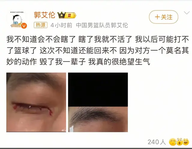 后续：队友道歉！CBA巨星血染训练场！郭艾伦右眼缝40针泣诉！