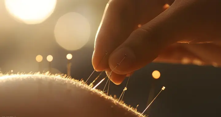 小针刀：游离于中医范畴之外的疗法