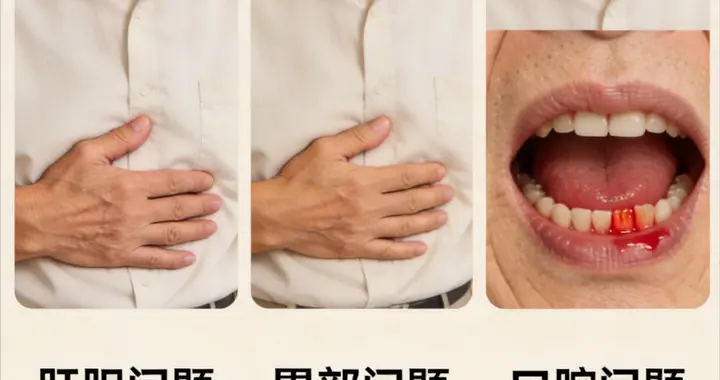 早上起床嘴巴苦、舌苔厚？可能是这3个器官在求救，别不当回事