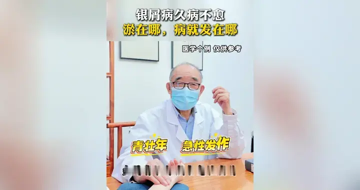 银屑病久病不愈，淤在哪，病就发在哪