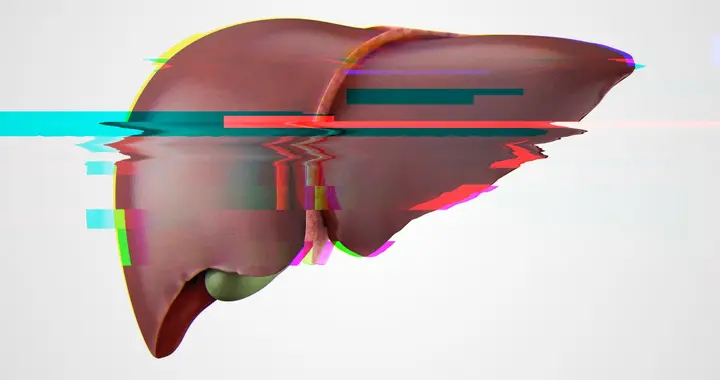 肝硬化好不好逆转呢？医生详解逆转肝硬化的4个关键