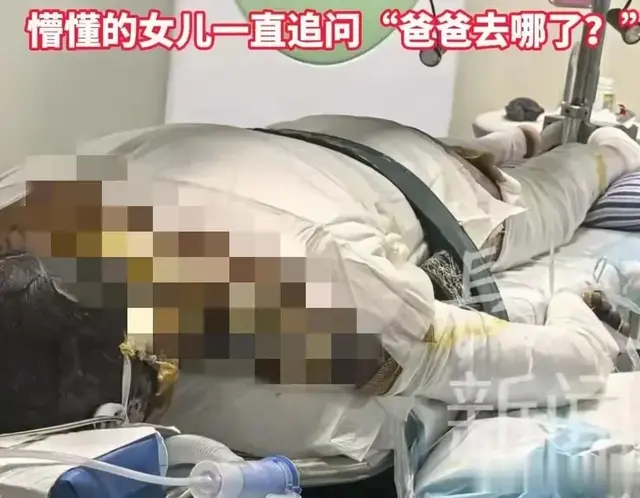 南昌燃气爆炸致男子全身烧伤，父亲含泪求助，透露出事原因引愤怒