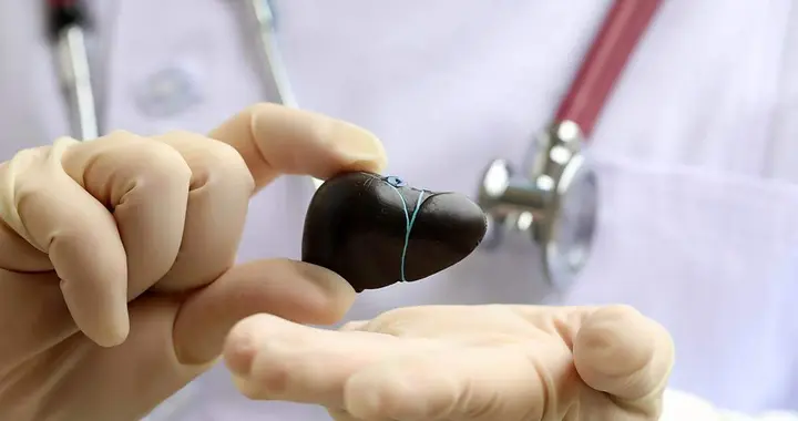 查出肝癌，不能吃花生？医生：想肝好，少吃2白1黄，肝会感激你