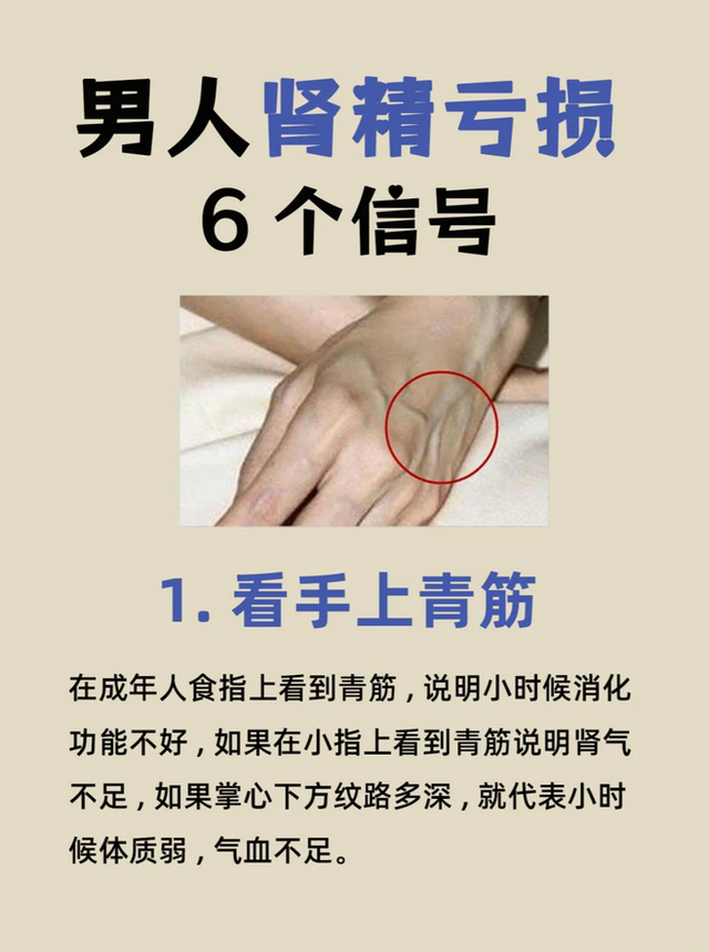 男生肾精亏虚的6个信号，看看你占了几个？