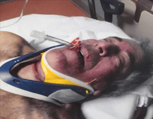 爱泼斯坦自杀照曝光！被活活勒死，特朗普甩锅盖茨，果然不止吃人