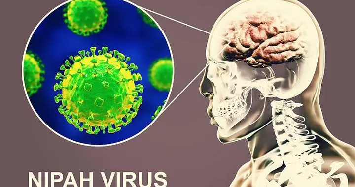 我国尚未发现尼帕病毒病例