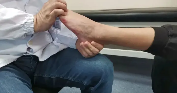 突然走不了路，原来是“腿梗”！医生：轻则“要腿”，重则“要命”