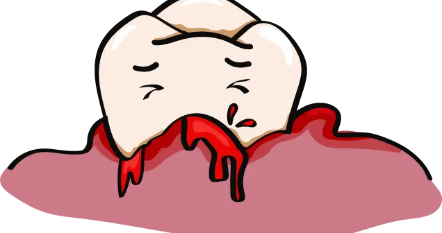 牙龈出血？你的牙齿在“求救”！