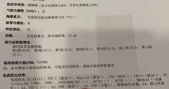 66岁肺腺鳞癌，术后5个月，骨转移——病理报告解读