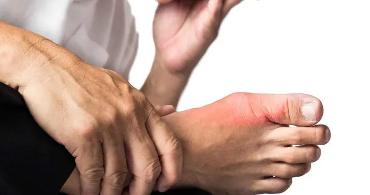 萝卜是尿酸的杀手？专家建议：若尿酸超标，或可多吃这4物