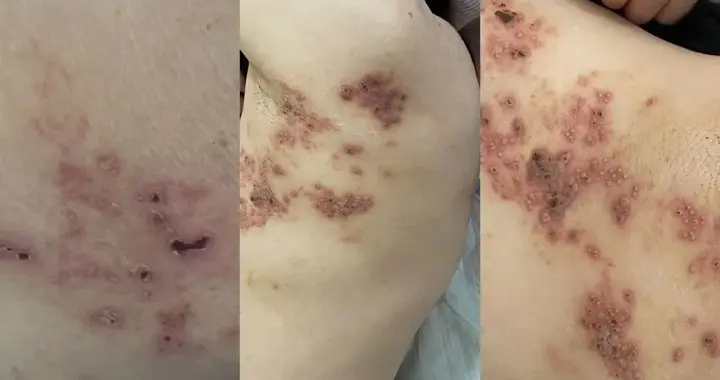 对话连云港市妇幼保健院疼痛康复科主任崔吉正