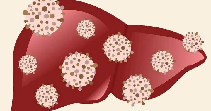 肝细胞GPR75通过GNAI2依赖性信号通路加剧MASH的机制研究