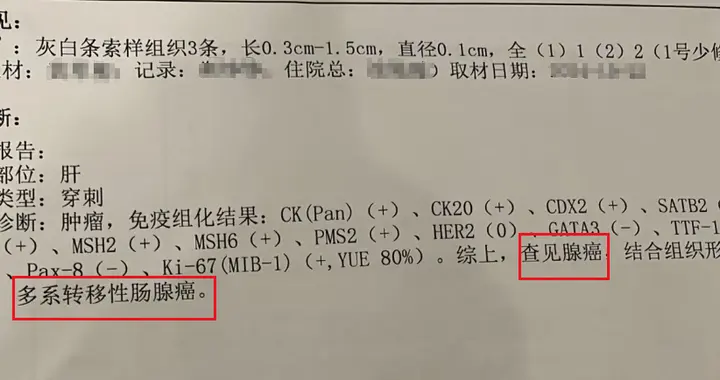 67岁肠癌，肝转移——病理报告解读