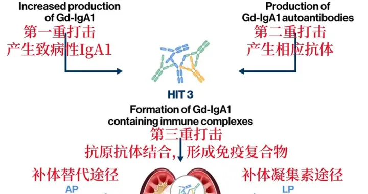 吕继成教授团队新疗法：清除肾脏沉积免疫复合物，降解致病性IgA