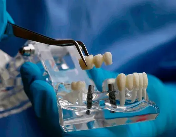 女子花6万做种植牙，结果牙全没了？