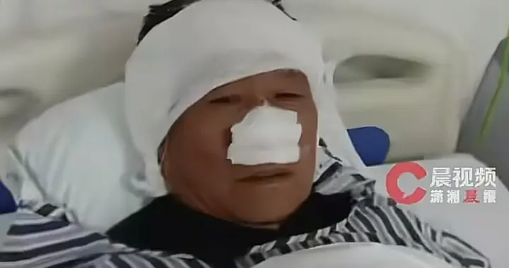 七旬老人勇斗歹徒被咬掉鼻子还被吞下，老党员，20年前抓过盗窃犯