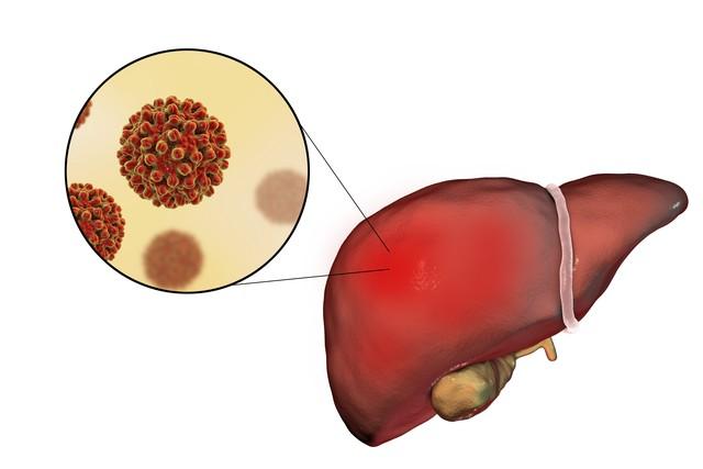 肝脏若是受损，身体可能出现哪些表现？还是及时了解比较好