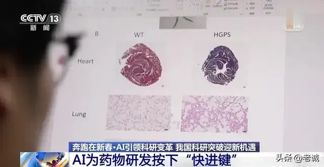 未来体检只需一滴血AI提前15年算出癌症糖尿病中老年必看