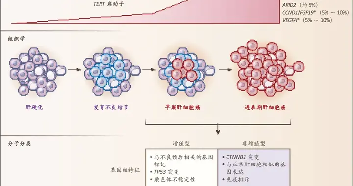vNKT细胞免疫治疗用于二线治疗后进展的晚期肝细胞癌的单臂II期临床研究