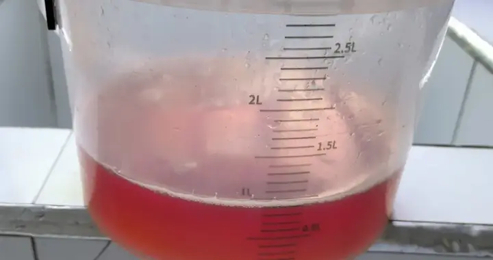 糖尿病患者尿颜色变红，怎么回事？看看你有吗？