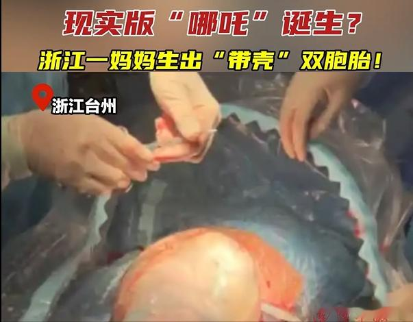 哪吒浙江“分吒”降生！孕妇生出“带壳双胞胎”：魔丸灵珠聚全了