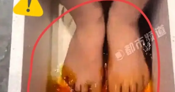泡沫箱+碘伏泡脚治脚臭？宝妈神操作遭吐槽：治标不治本