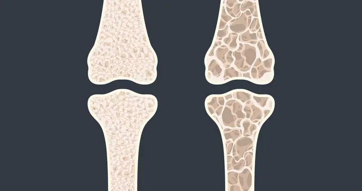 身上疼，腰背痛与骨密度低有关系吗？