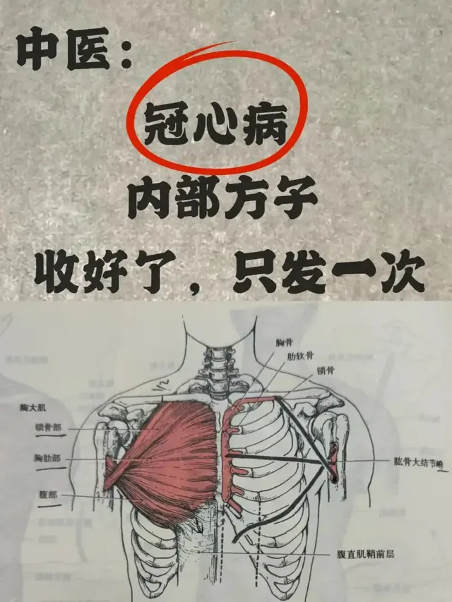 老中医不外传的秘方！冠心病患者必看，内部方子大放送！