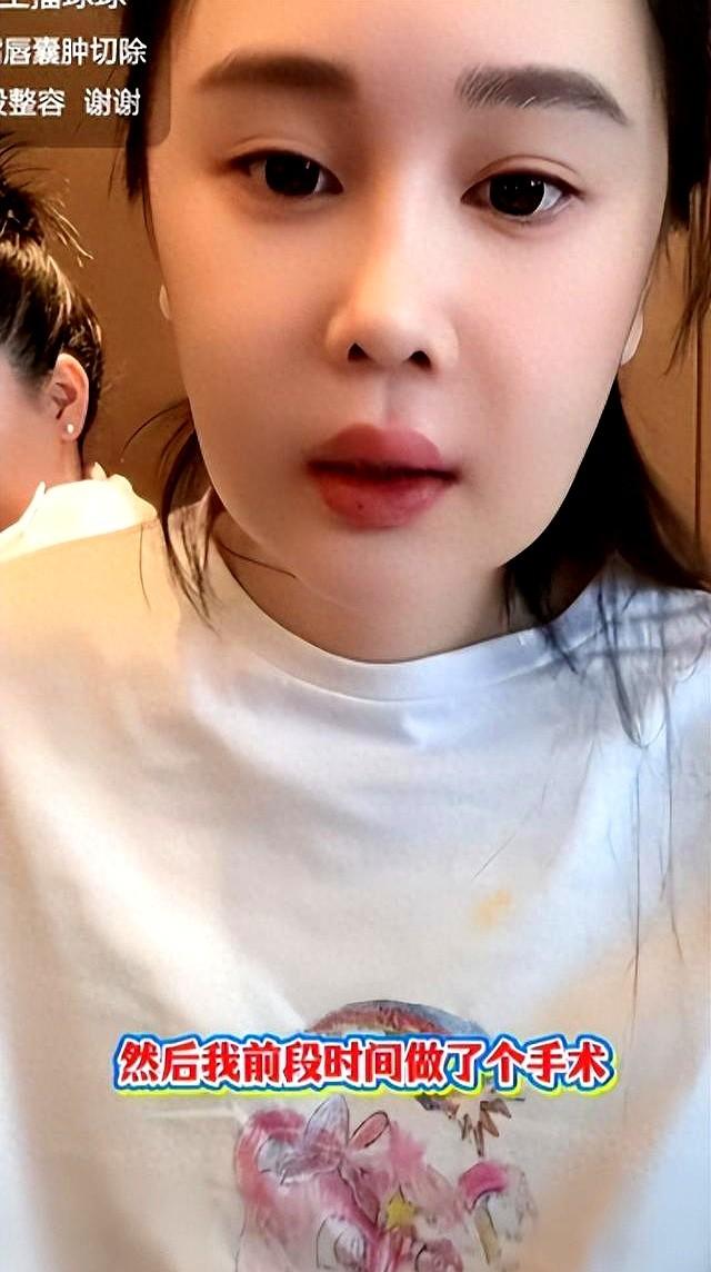 有钱不如有好身体，赵本山女儿重度抑郁发作，家财万贯也得自己扛